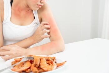The Difference Between Food Allergies and Food Sensitivities: What You Need to Know - Blog Post